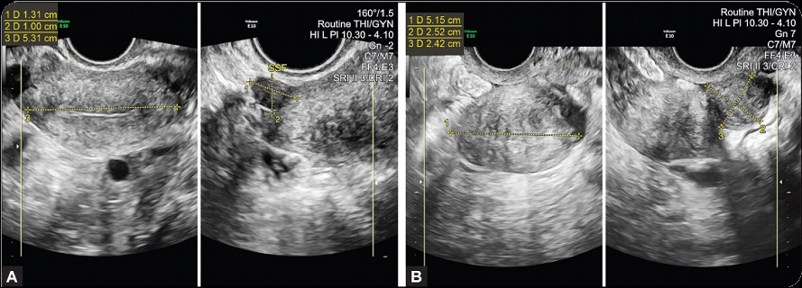 Case 1 - Medical scan